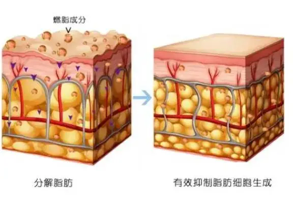 甜菜堿可以促進(jìn)脂肪酸氧化，加快脂肪的分解速率，起到減少脂肪堆積的作用