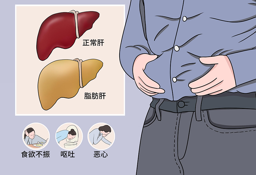 氯化膽堿：神經(jīng)遞質(zhì)乙酰膽堿合成的必需物質(zhì) | 預(yù)防脂肪肝的奇跡